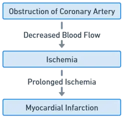 Mechanism of Myocardial Infarction Mechanism of Myocardial Infarction