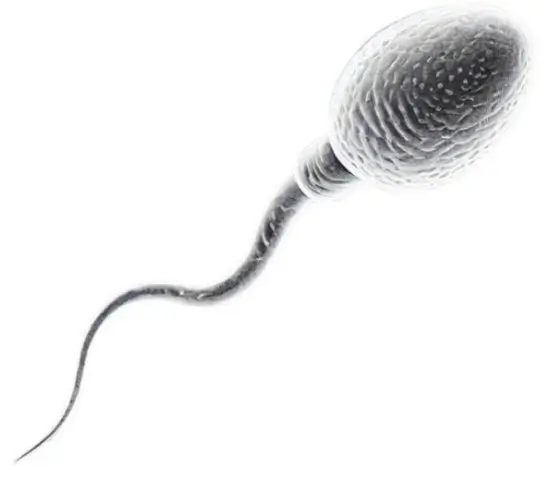 Sperm